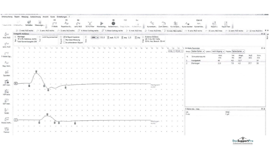 praxisnahe Schulungen in der Elektroneurographie